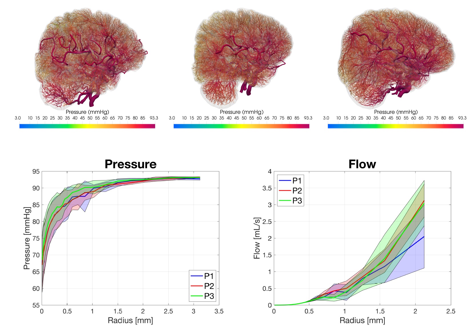 뇌혈관 압력 및 혈류 분석 - 전산유체역학 시뮬레이션 결과